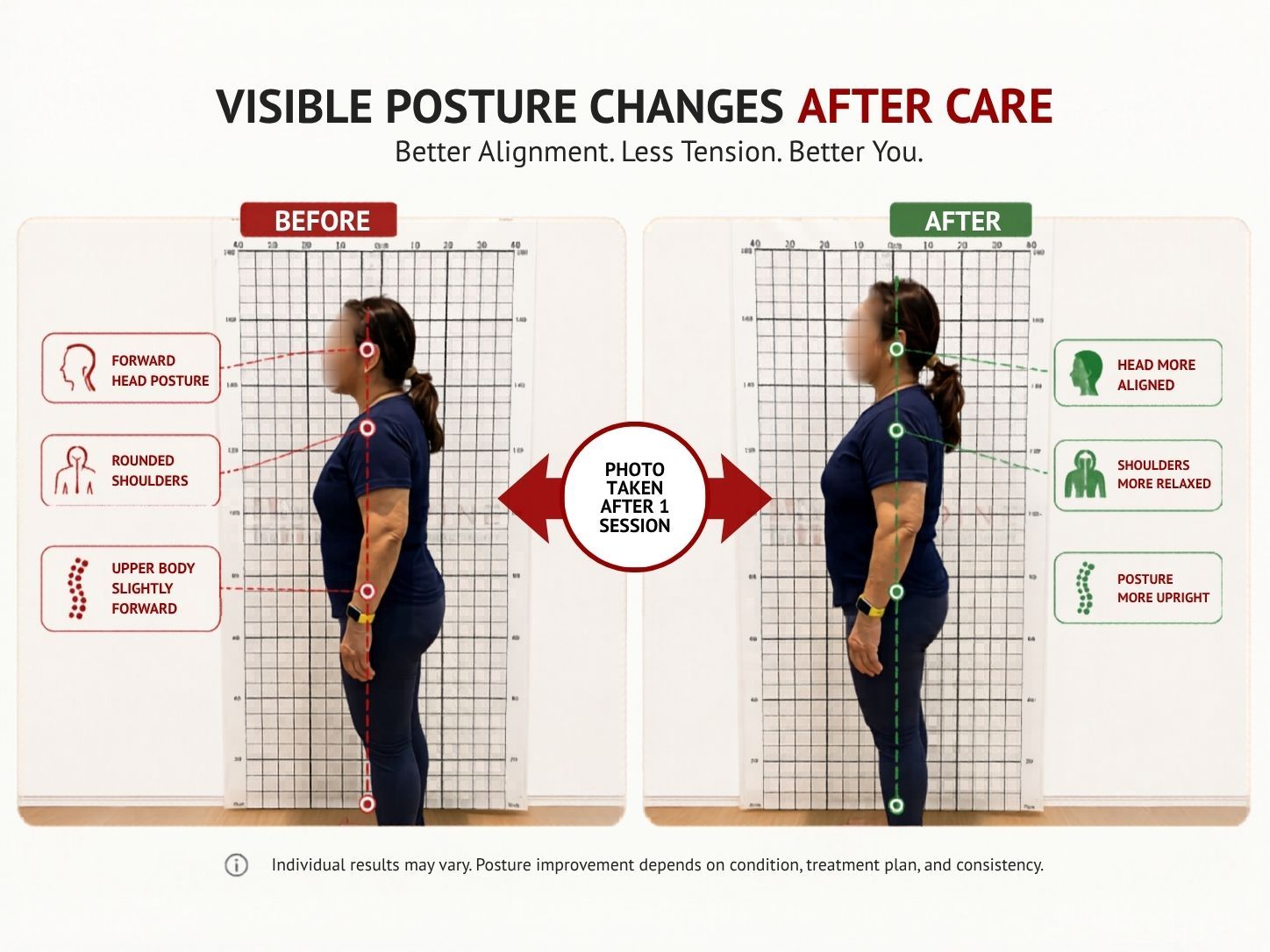 Actual One Spine patient before and after posture correction showing improved posture alignment